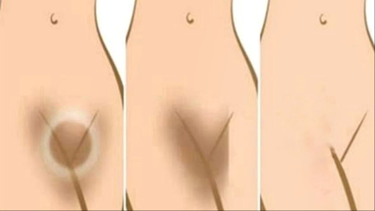 Hollywood actress naked pics